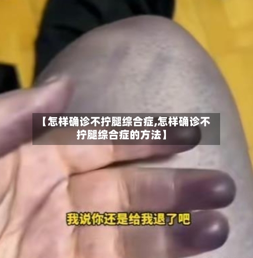 【怎样确诊不拧腿综合症,怎样确诊不拧腿综合症的方法】-第3张图片