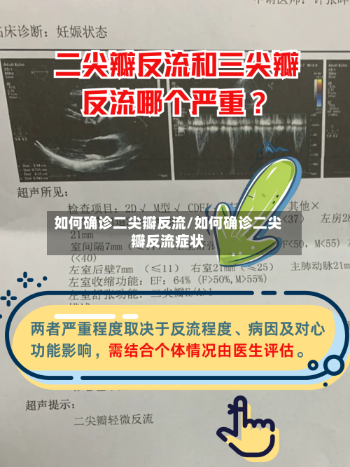 如何确诊二尖瓣反流/如何确诊二尖瓣反流症状