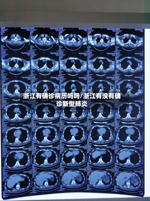 浙江有确诊病历吗吗/浙江有没有确诊新型肺炎
