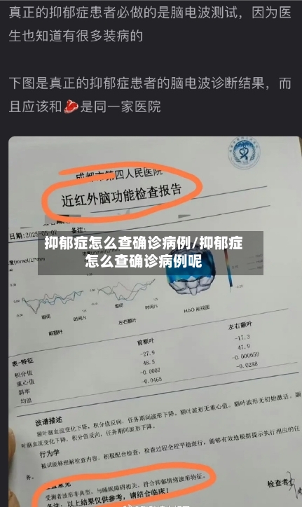 抑郁症怎么查确诊病例/抑郁症怎么查确诊病例呢