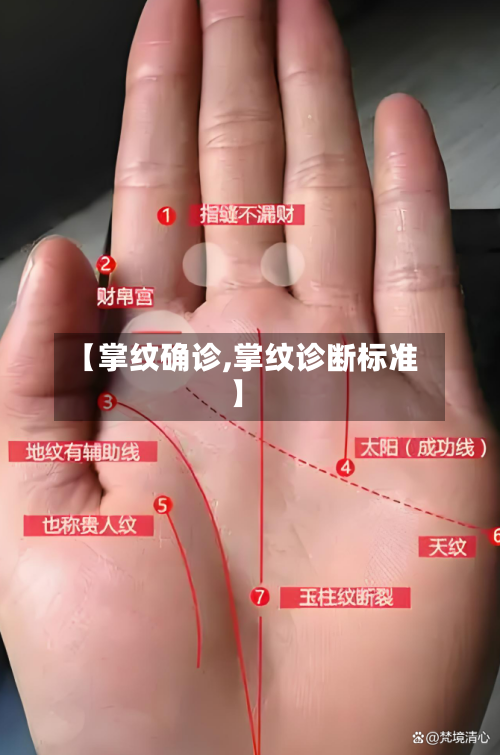 【掌纹确诊,掌纹诊断标准】