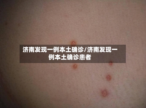 济南发现一例本土确诊/济南发现一例本土确诊患者