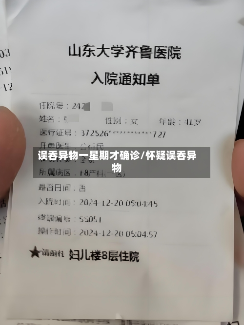 误吞异物一星期才确诊/怀疑误吞异物