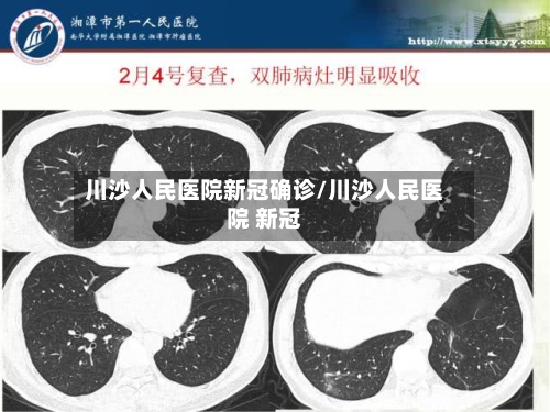 川沙人民医院新冠确诊/川沙人民医院 新冠
