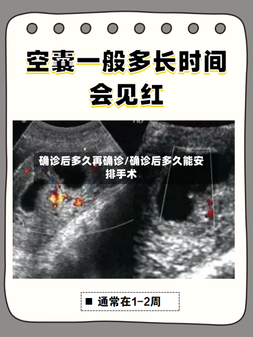 确诊后多久再确诊/确诊后多久能安排手术-第3张图片