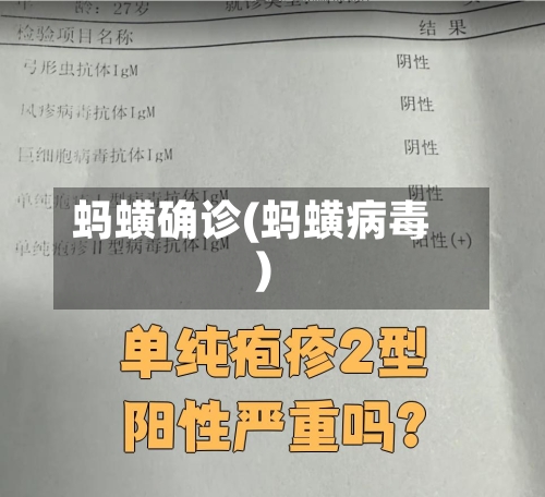 蚂蟥确诊(蚂蟥病毒)-第2张图片