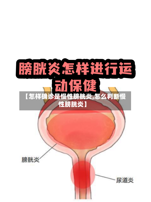【怎样确诊是慢性膀胱炎,怎么判断慢性膀胱炎】