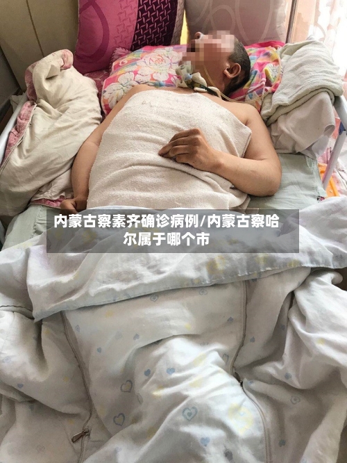 内蒙古察素齐确诊病例/内蒙古察哈尔属于哪个市