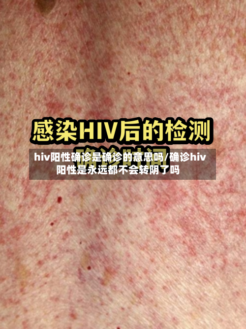 hiv阳性确诊是确诊的意思吗/确诊hiv阳性是永远都不会转阴了吗