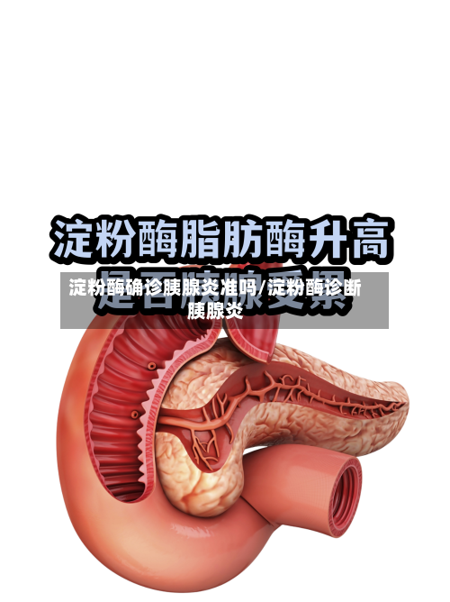淀粉酶确诊胰腺炎准吗/淀粉酶诊断胰腺炎-第3张图片