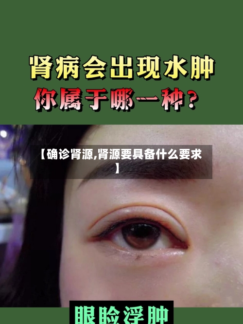 【确诊肾源,肾源要具备什么要求】-第2张图片