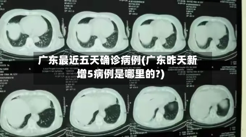 广东最近五天确诊病例(广东昨天新增5病例是哪里的?)-第3张图片