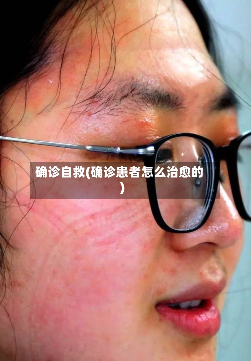 确诊自救(确诊患者怎么治愈的)-第3张图片