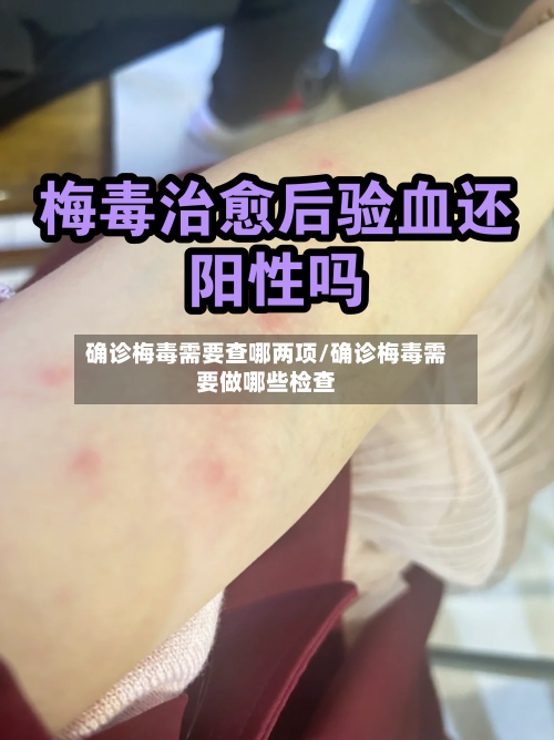确诊梅毒需要查哪两项/确诊梅毒需要做哪些检查-第2张图片